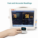 Φόρτωση εικόνας στο εργαλείο προβολής Συλλογής, Οξύμετρο Δακτύλου HD – Μέτρηση Οξυγόνου &amp; Παλμών
